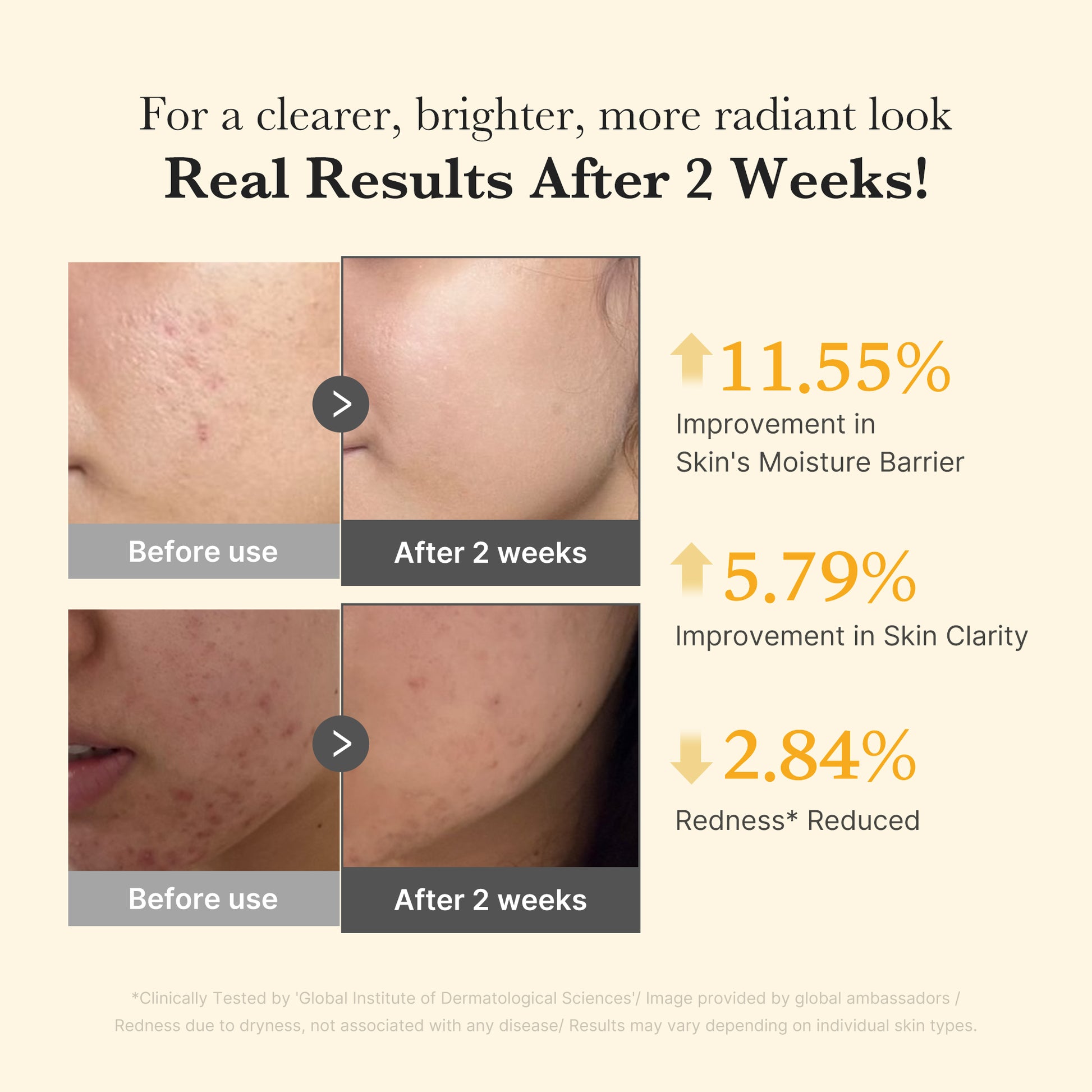 Kojic Acid Turmeric Capsule Serum - Image 4