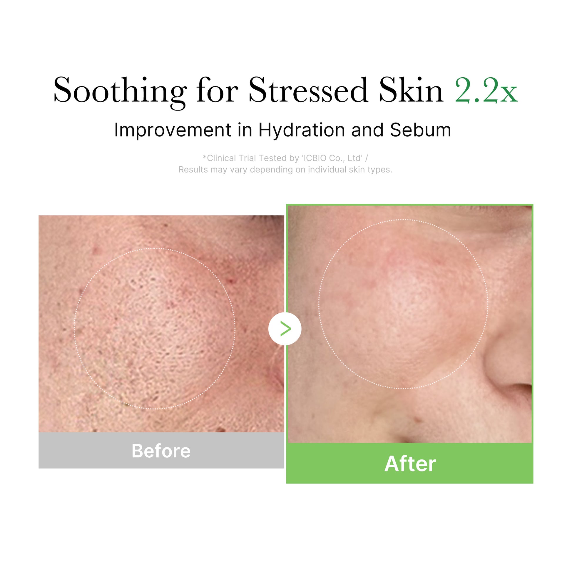 Exosome Cica Calming Full Set - Image 10