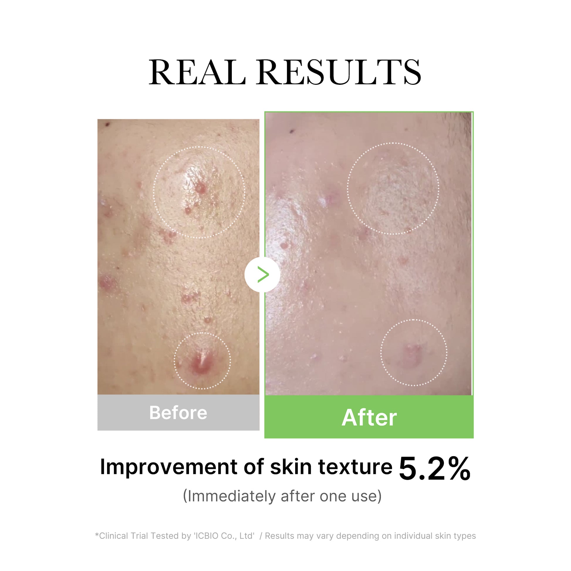 Exosome Cica Calming Ampoule - Image 5