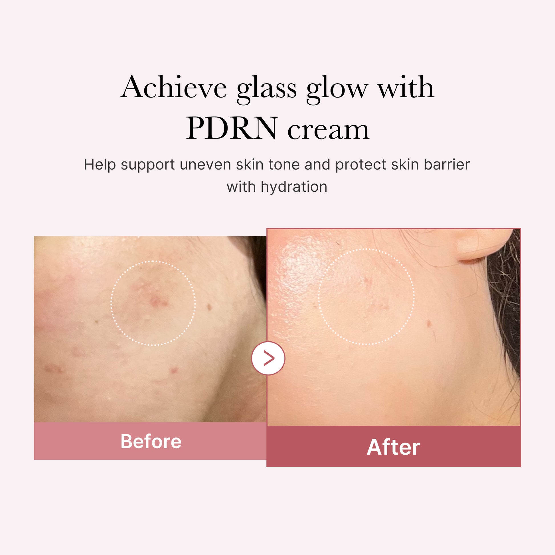 PDRN Pink Peptide Cream - Image 2