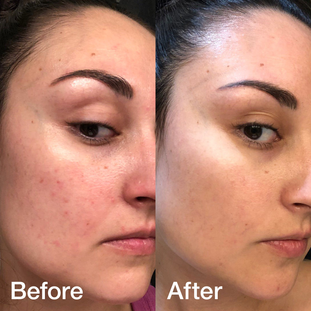 Glass Glow Duo - Image 3