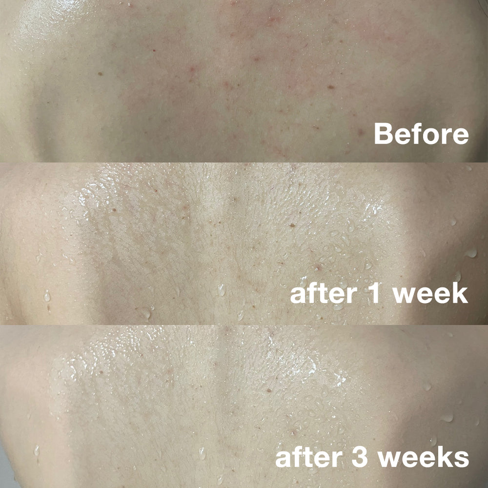 Red Line Ultimate Face & Body Care Set - Image 2